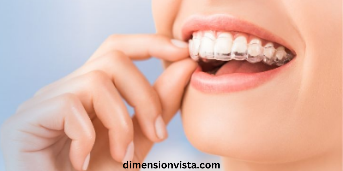 How Can Invisalign Transform Your Smile?